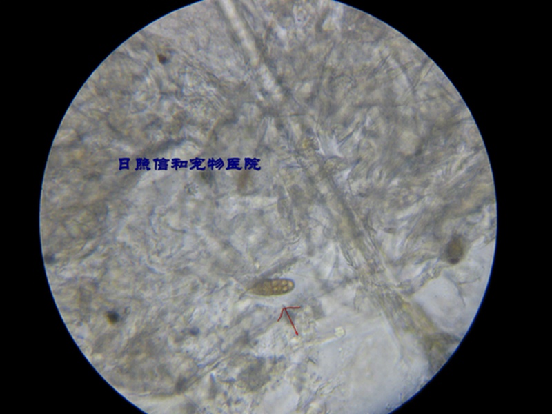 显微镜下面看到的真菌